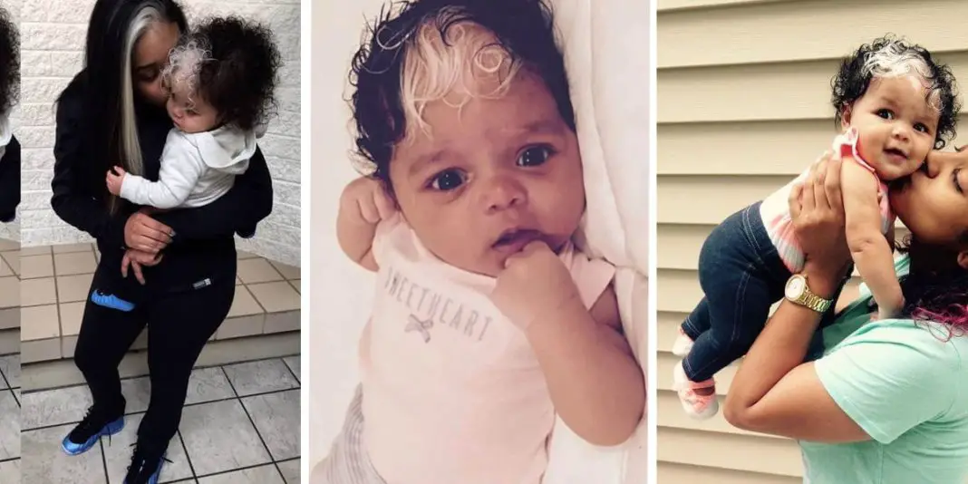 Ce bébé aux cheveux blancs hérité de sa mère fait le buzz-min